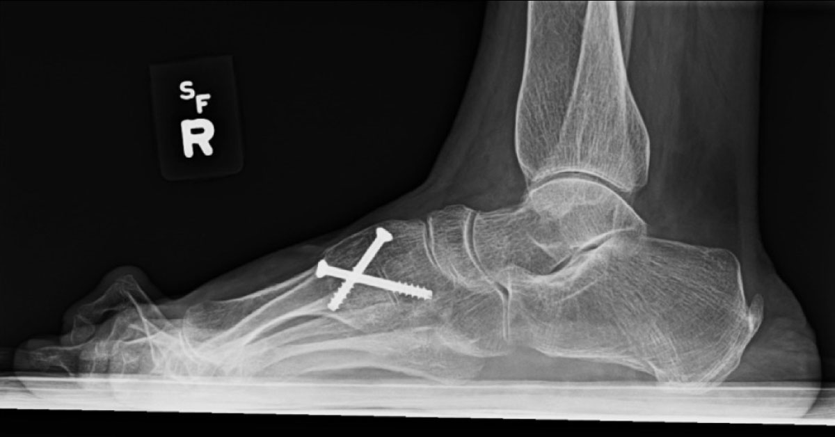 Spot The Podiatric Abnormality